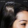 Toppik Hair Fiber, White (large 27.5 g, up to 50 applications)